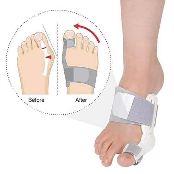 Bunion Splint Correctors (Tynor K-14) Universal Size